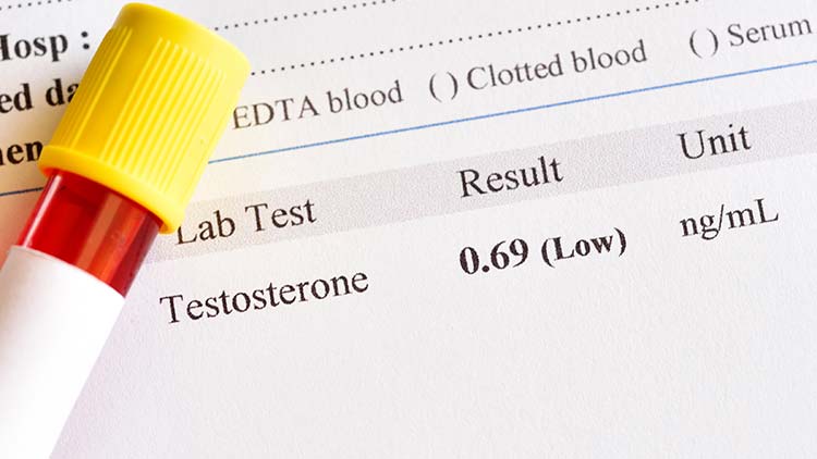 Low testosterone and ed